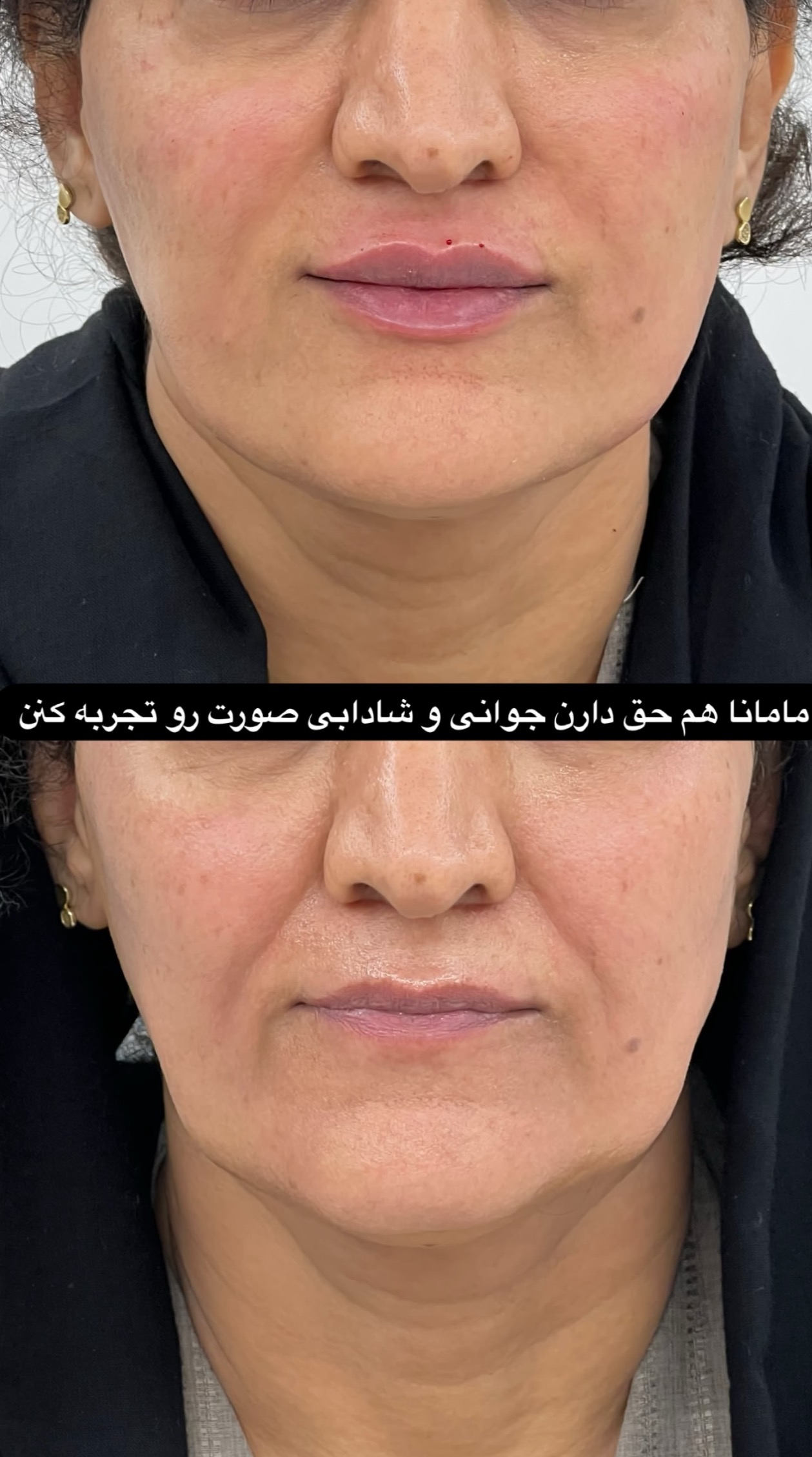 کلینیک زیبایی فیل بیوتی - تصویر 23