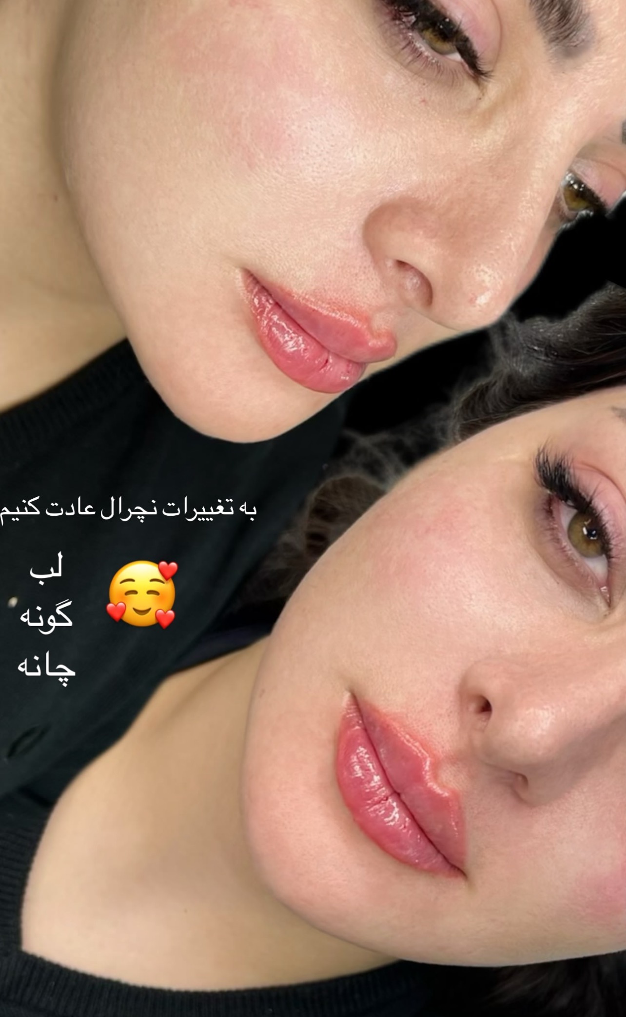 کلینیک زیبایی فیل بیوتی - تصویر 24