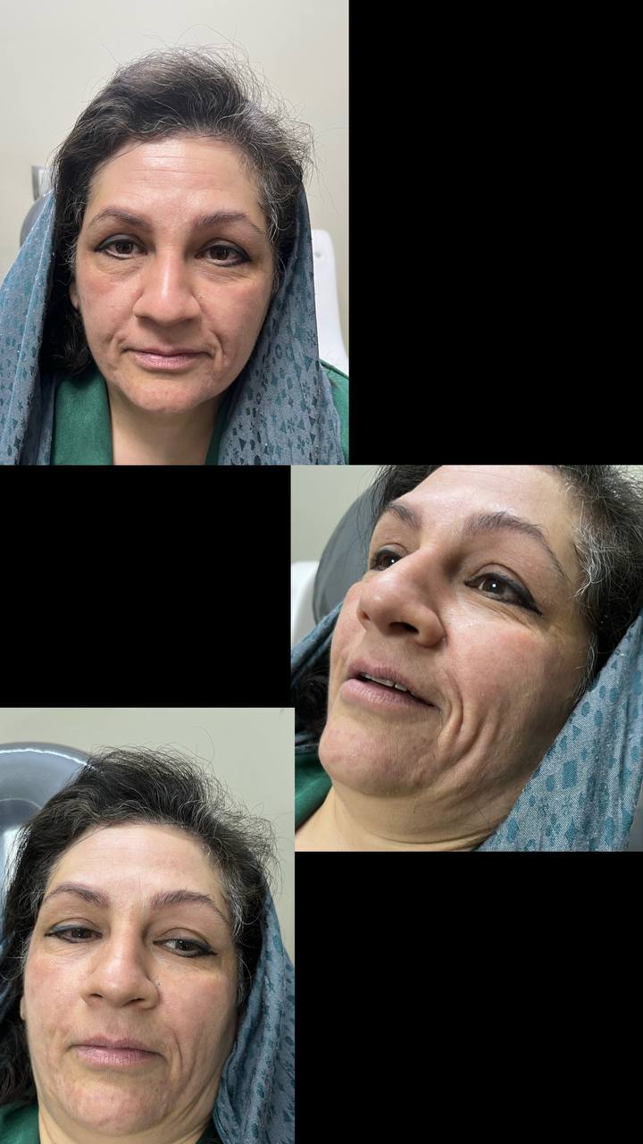 کلینیک زیبایی فیل بیوتی - تصویر 3