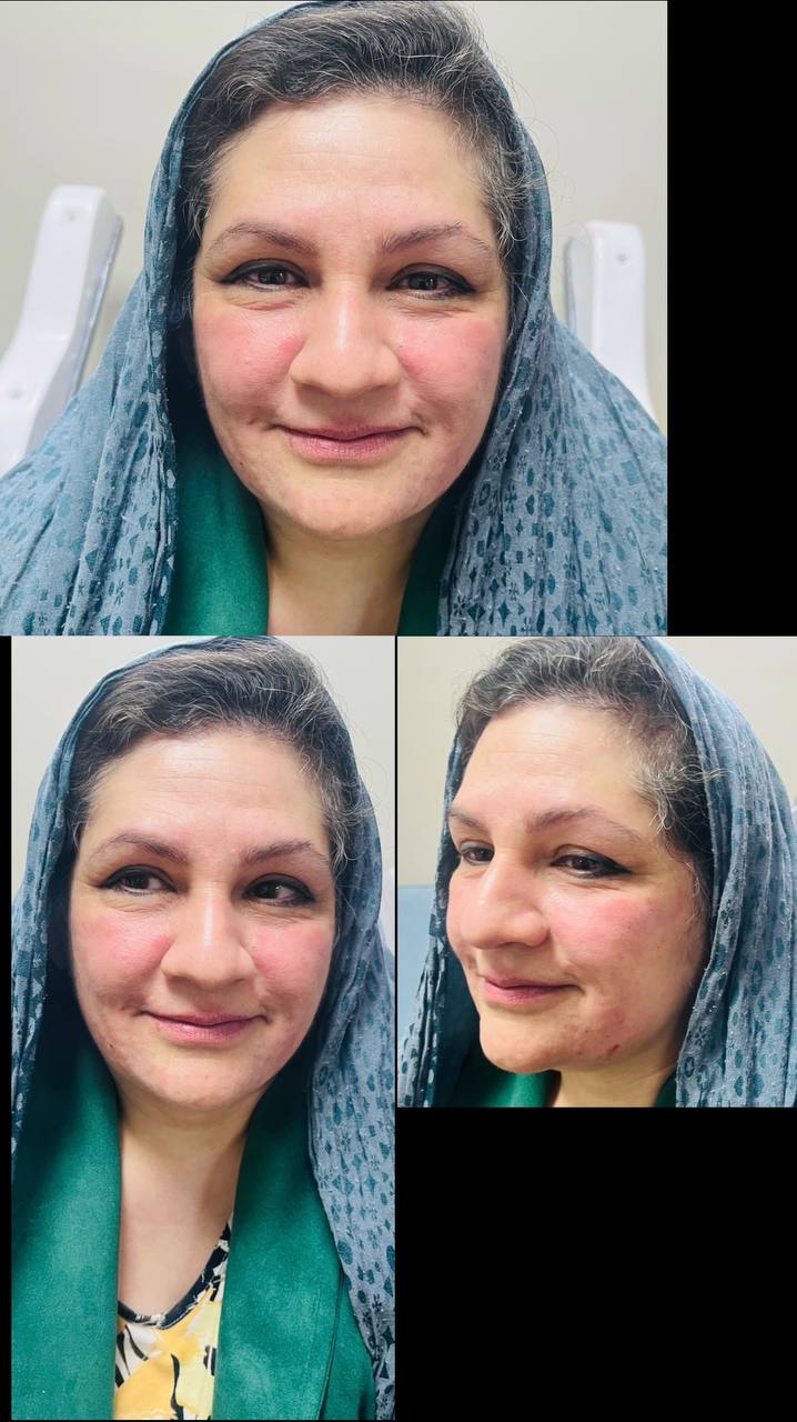 کلینیک زیبایی فیل بیوتی - تصویر 1