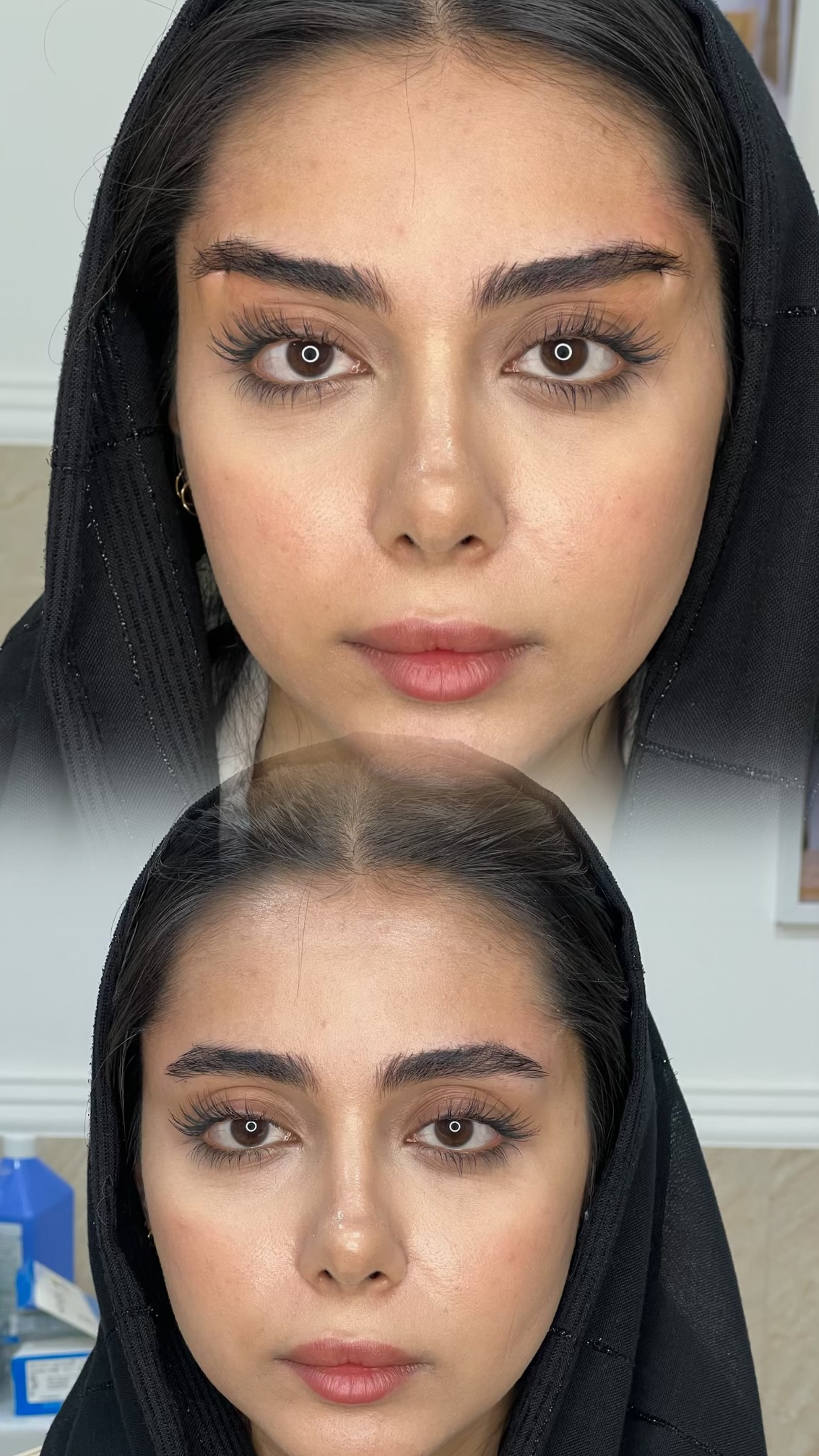 کلینیک زیبایی فیل بیوتی - تصویر 7