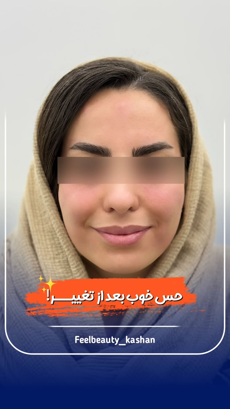  وقتی رضایت مشتری میاد جلو دوربین یعنی کارمون رو درست انجام دادیم ✨
