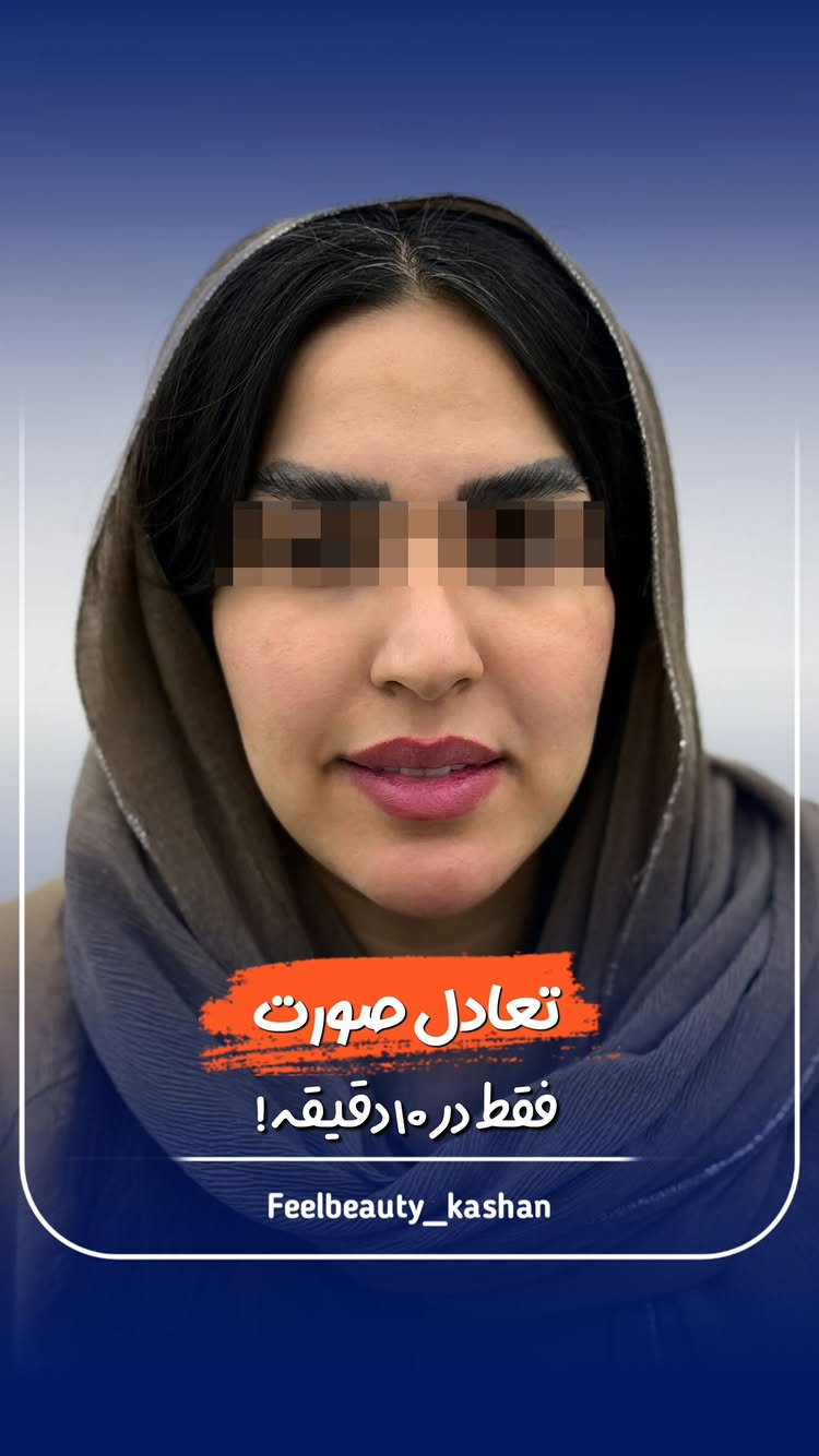  💎 کوچیکترین تغییر، بزرگترین تفاوت! 💎