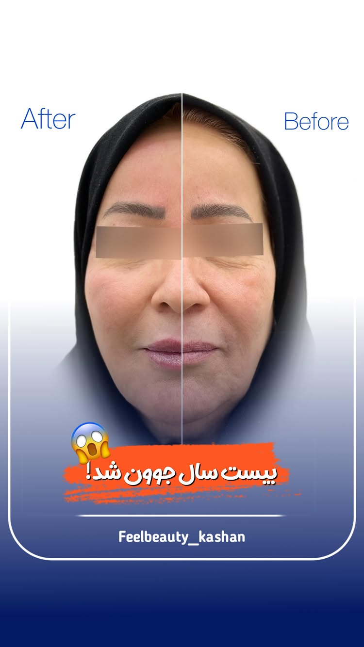  سن فقط یه عدده…