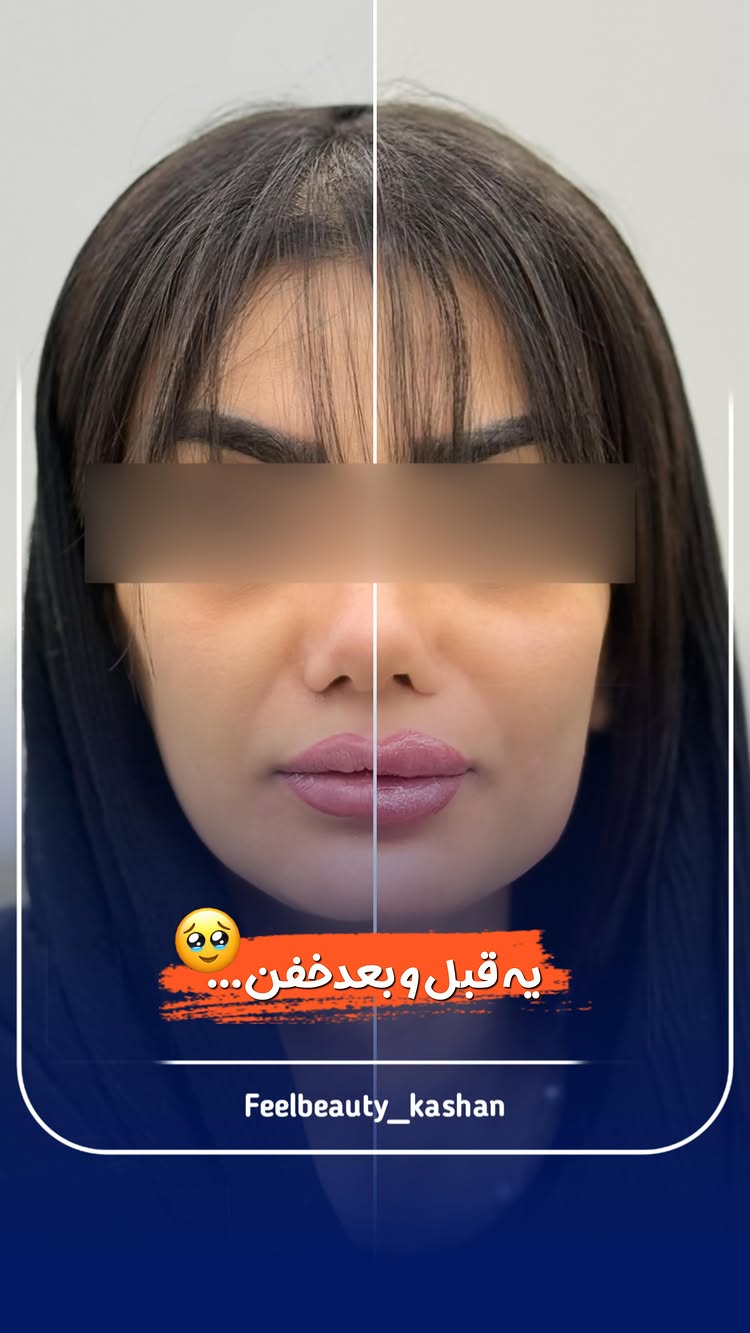 نظرتو راجب این قبل و بعد خفن بهم بگو…