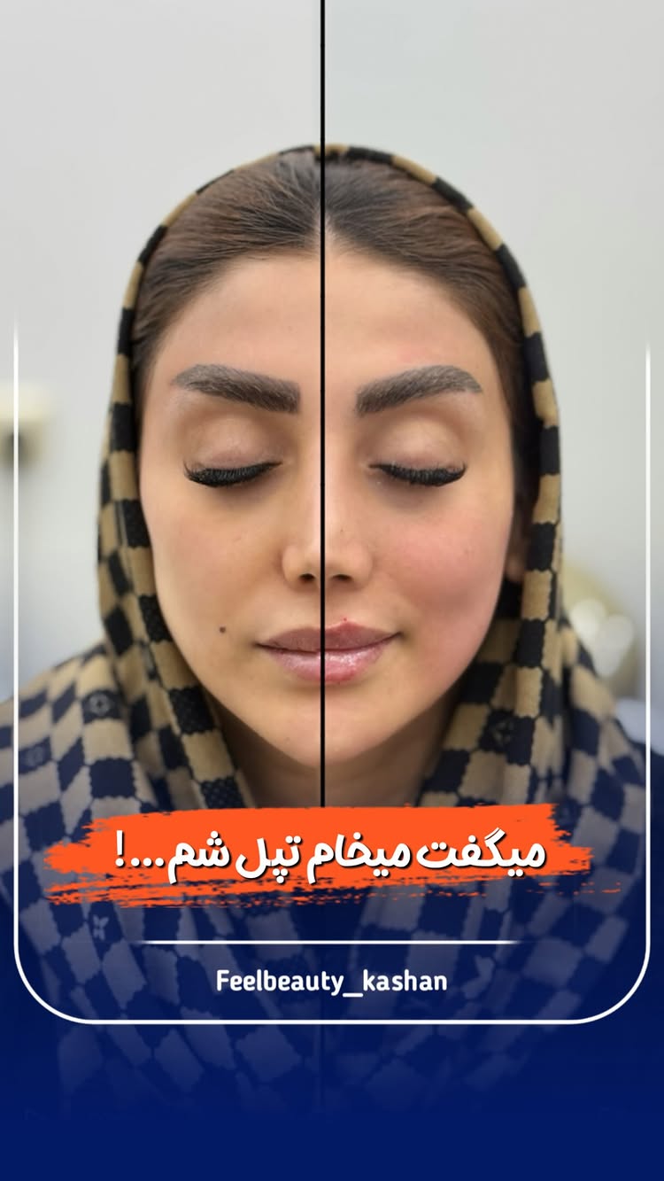اگه صورتت لاغره و همیشه حس میکنی گونههات خالیه، این پست مخصوص توئه!