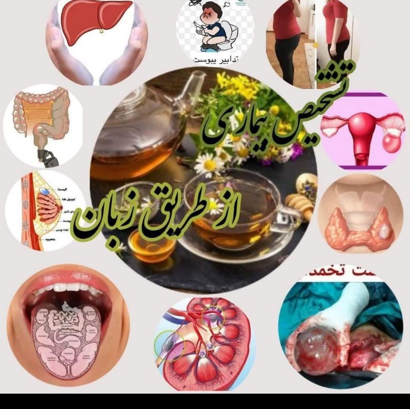نیوشا