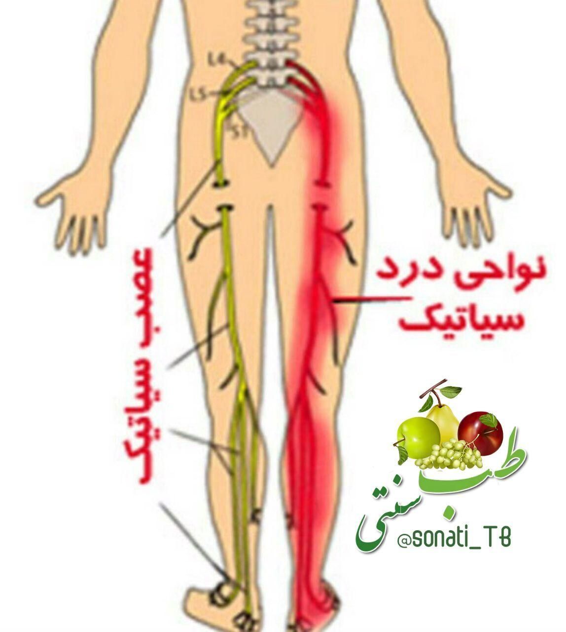 حجامت و زالودرمانی
