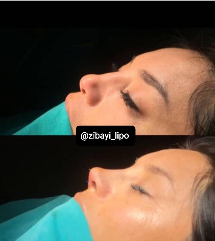 جراحی زیبایی  اقساطی