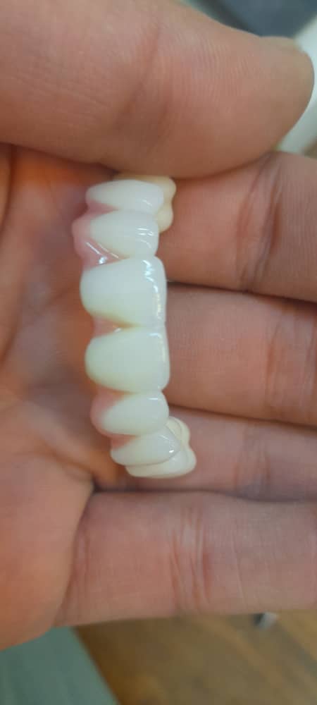 طراحی طرح لبخند