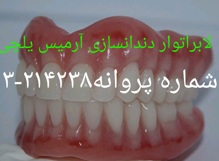دست دندان متحرک بدون سقف
