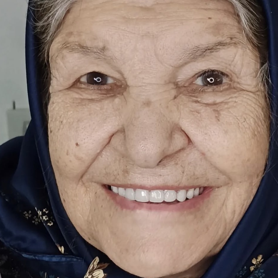 دندان مصنوعی ژاپنی