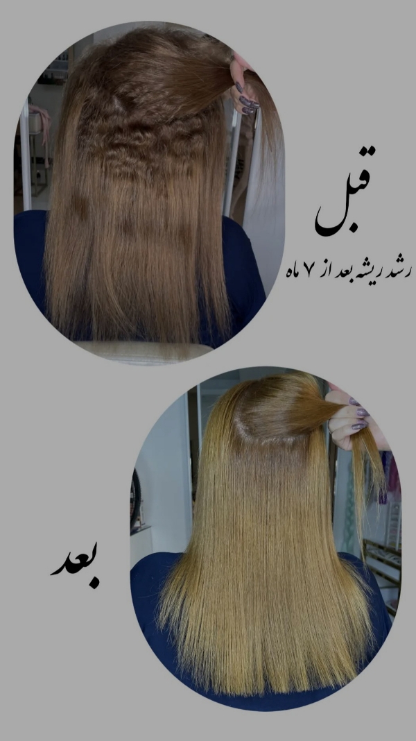 خدمات کراتین مو