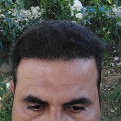 کاشت تخصصی موی طبیعی شیراز