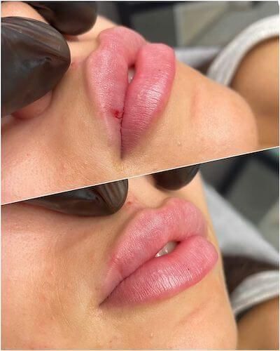 خدمات تخصصی تزریق ژل و بوتاکس