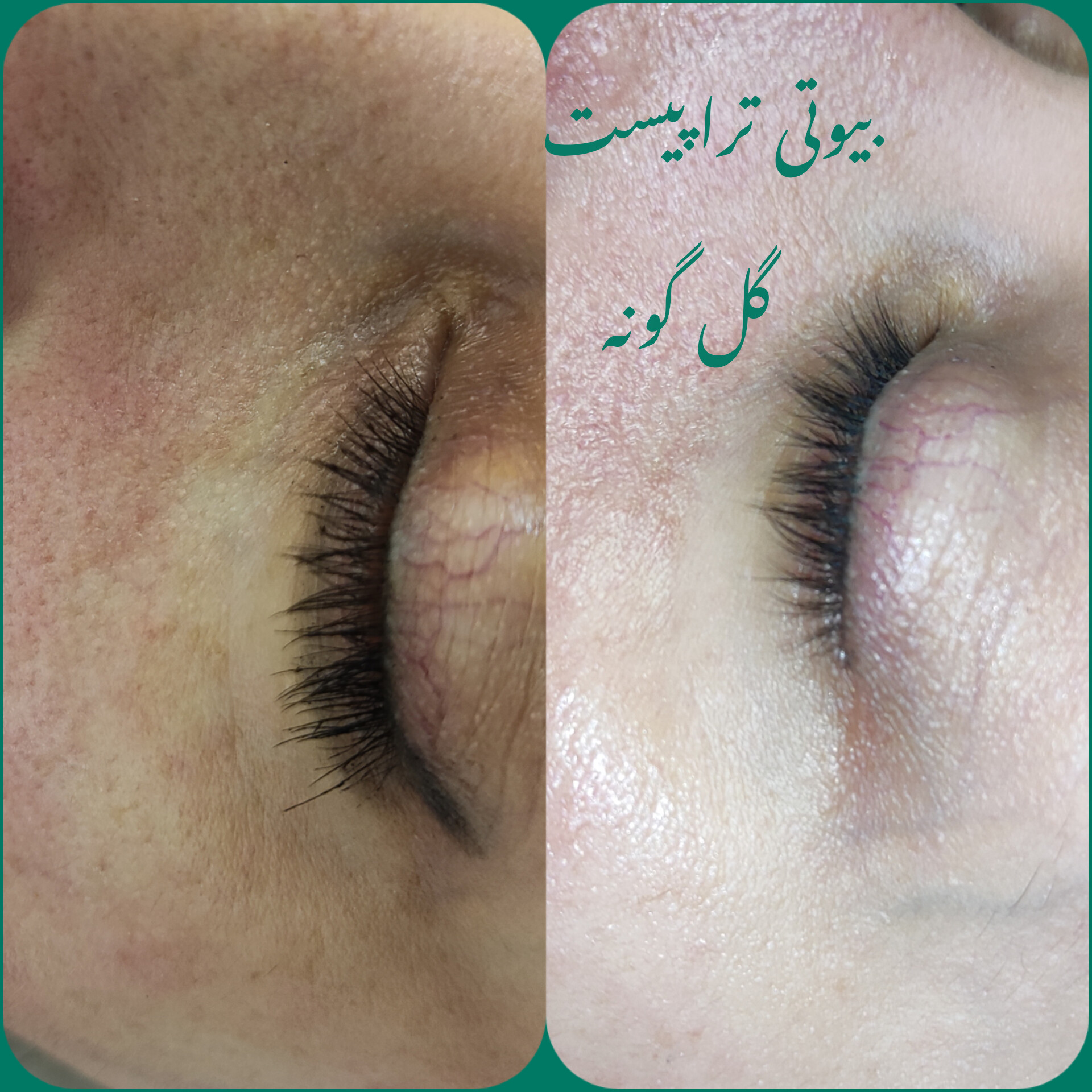 پاکسازی پوست