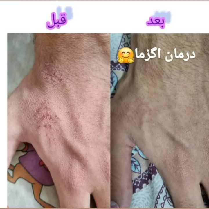 لک صورت
