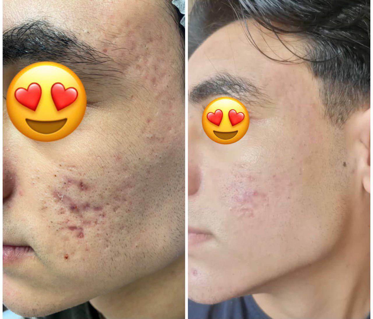 پاکسازی و فیشال تخصصی