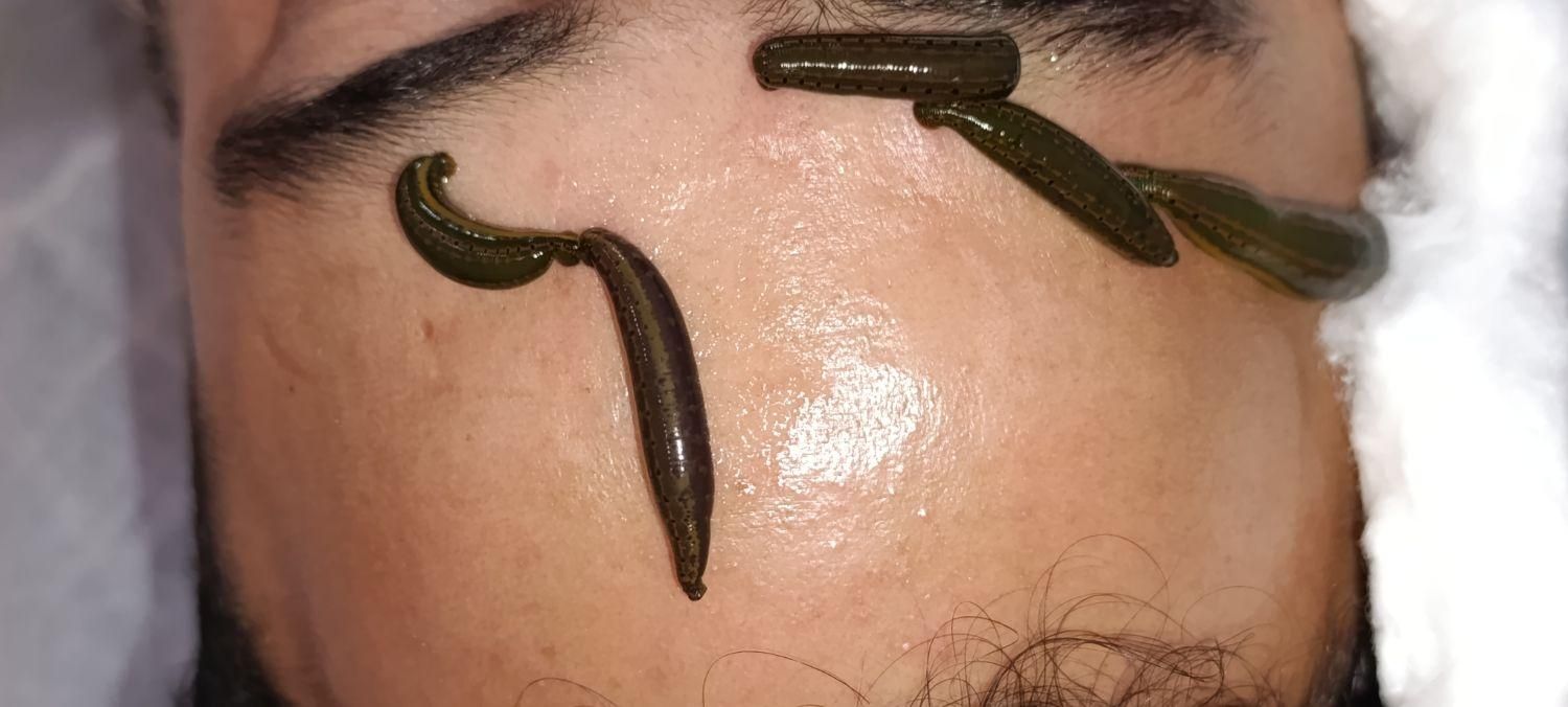 تخصصی کارتو یاد بگیر،ویژه ی علاقمندان ب طب سنتی