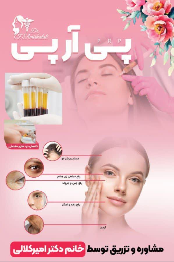 پی آر پی PRP