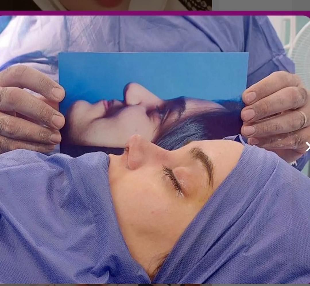 جشنواره عمل بینی لیفت شقیقه اسلیو معده و پیکرتراشی