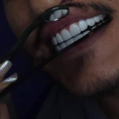 آموزش کامپوزیت