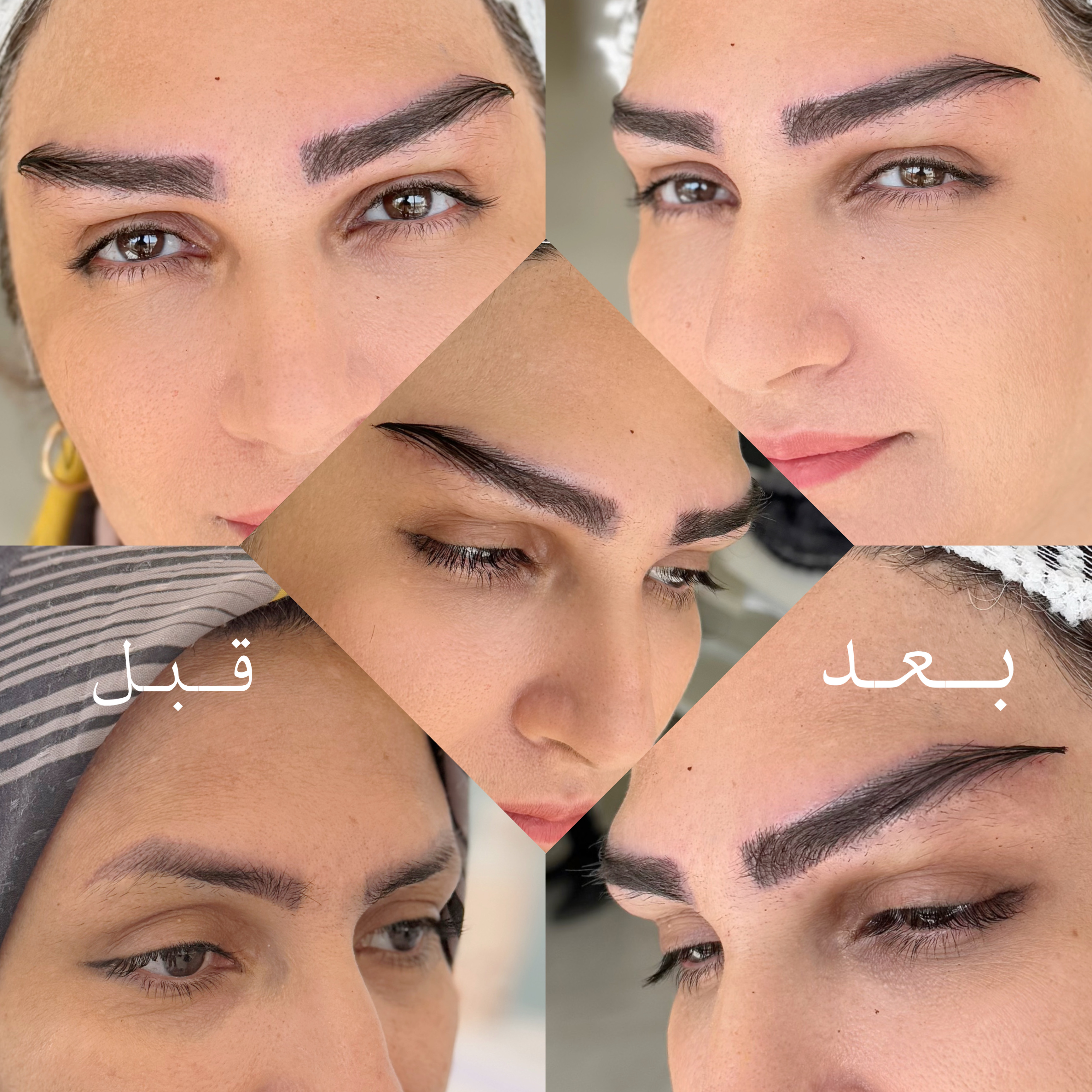 متد ليفت شقيقه