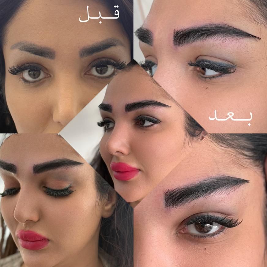 تخفیف ۵۰ درصدی کاشت ابرو‌ با خواب کاملا طبیعی