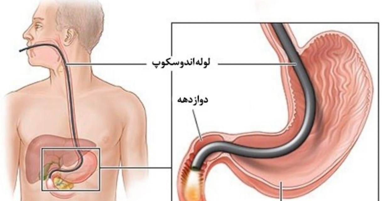 متخصص گوارش