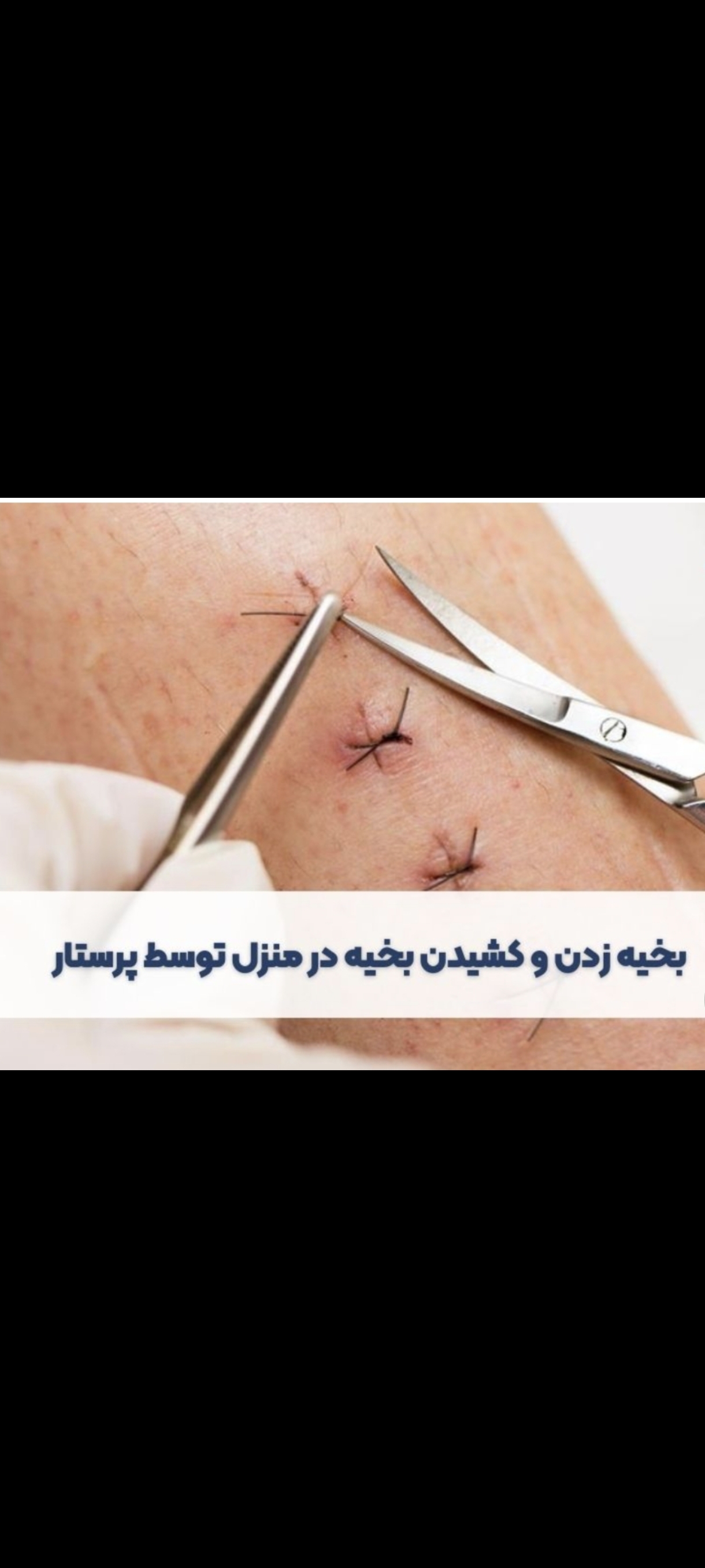 خدمات پرستاری در منزل