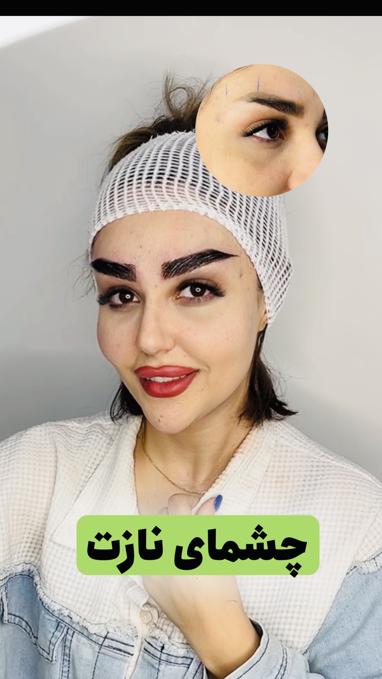 طراحی متناسب با چهره شما(طراحی لیفت شقیقه)