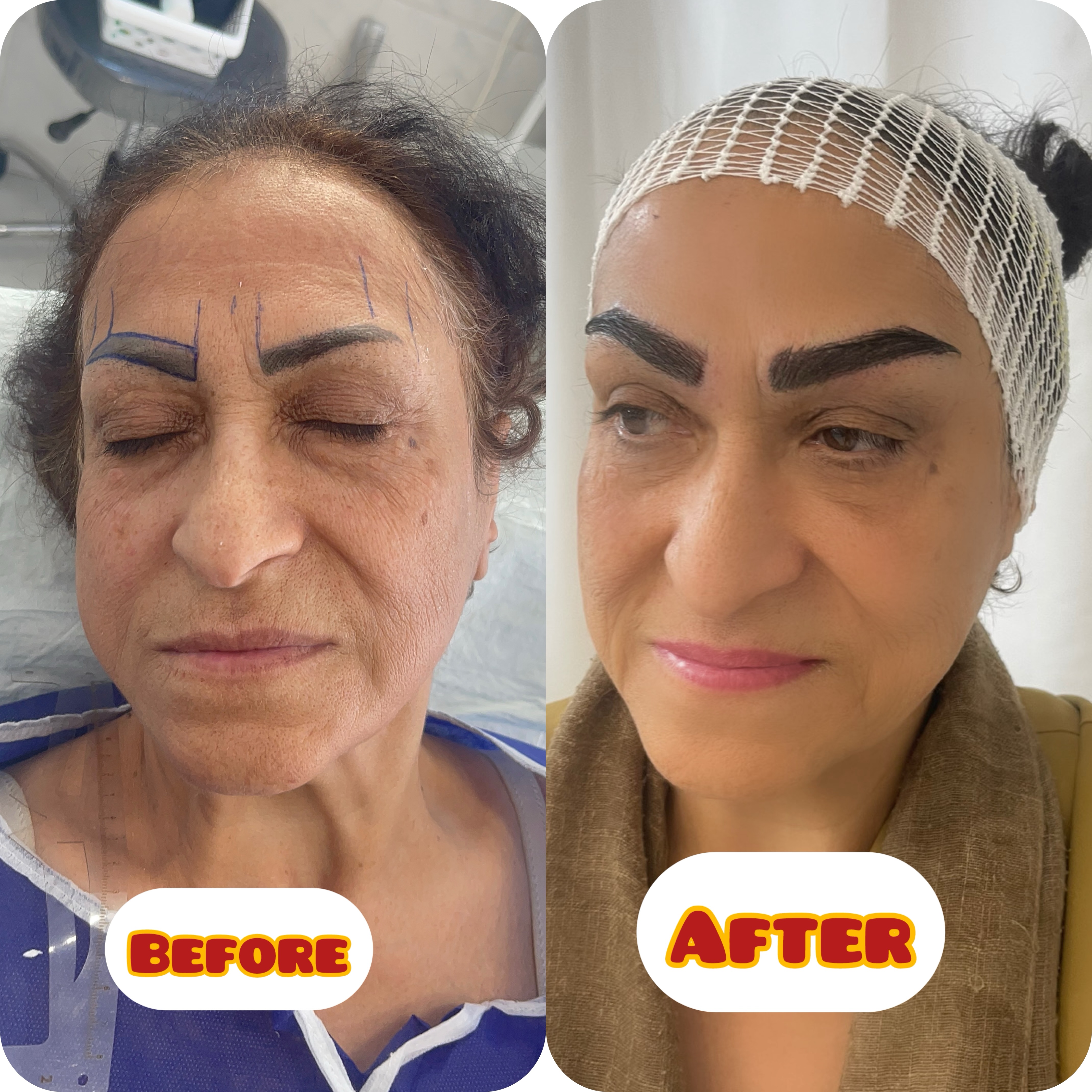 طراحی لیفت روسی