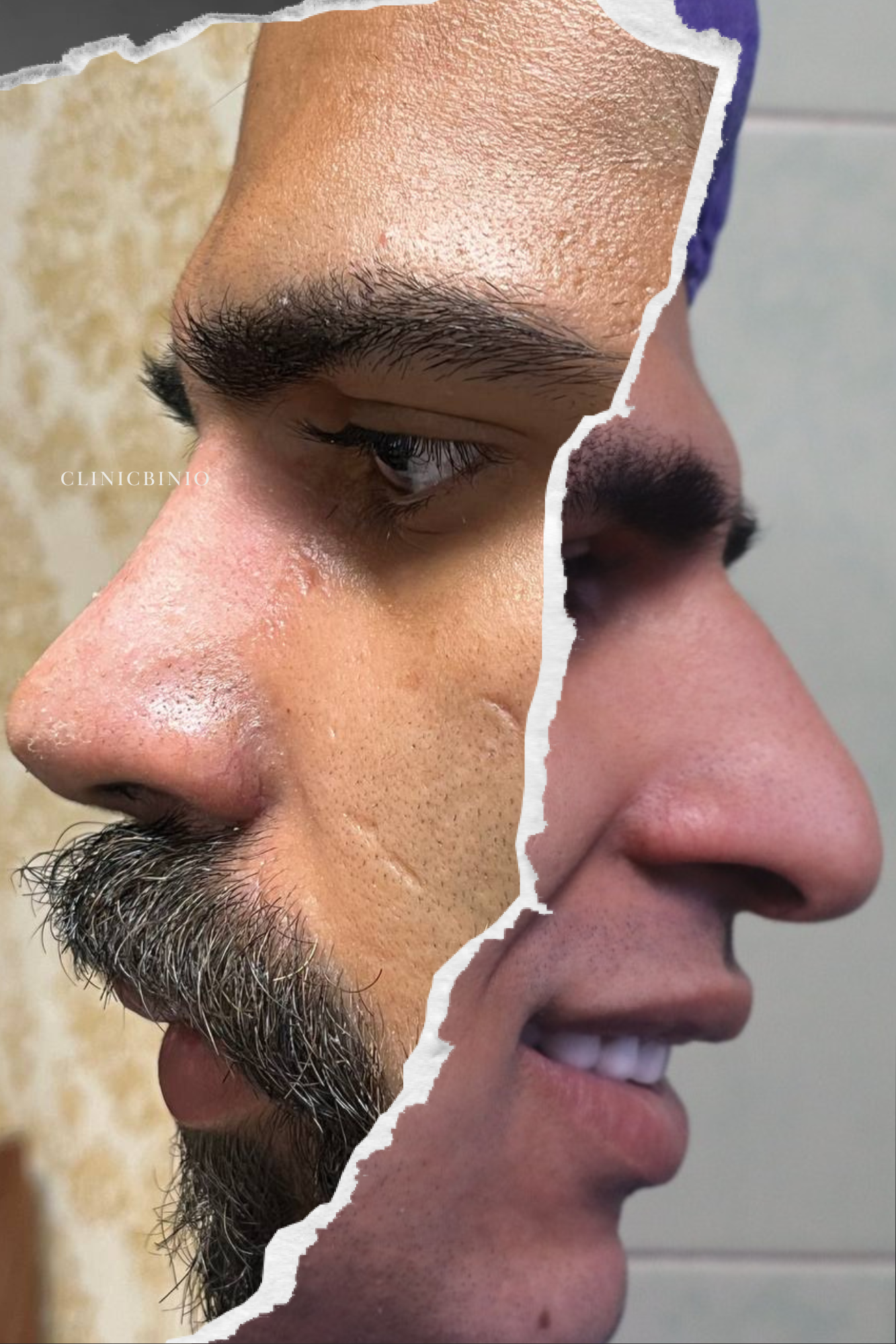 شاهکار تیغ جراحی