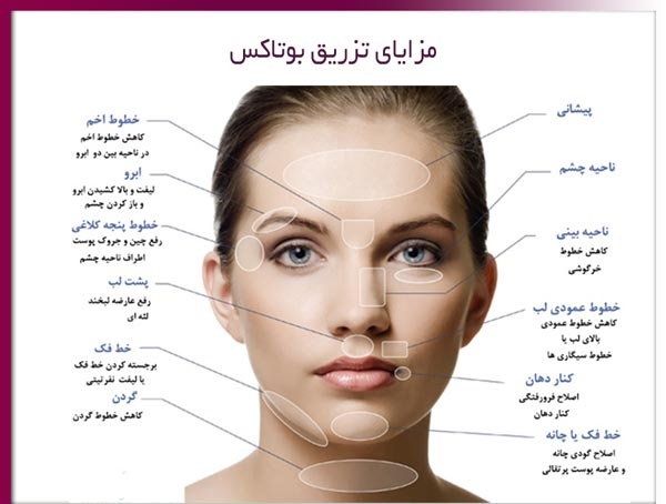 فروش و اموزش ژل و بوتاکس