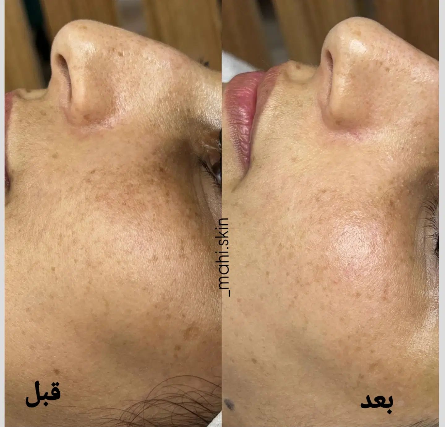 نیازمند مدل فقط با هزینه ی مواد برای تکمیل البوم