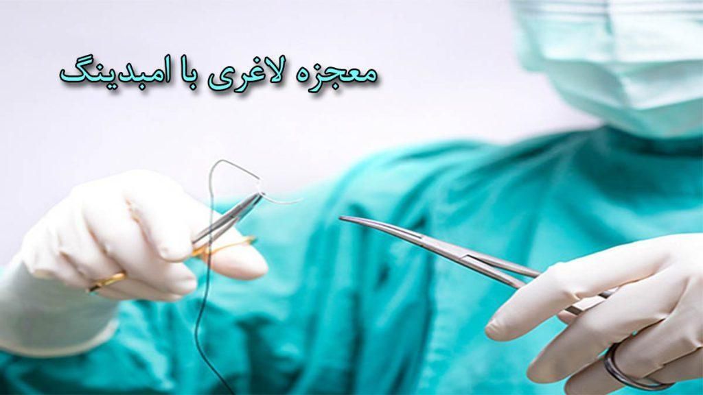 امبیدینگ فقط ۵میلیون وهردستگاه لاغری۱۹۹ هزار تومان