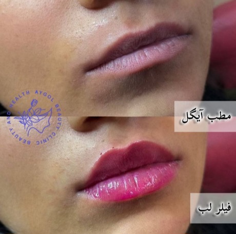 مطب زیبایی آیگل