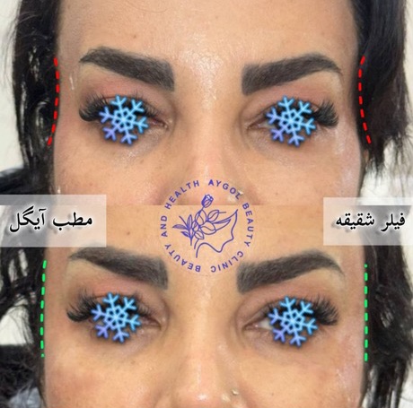 مطب زیبایی آیگل