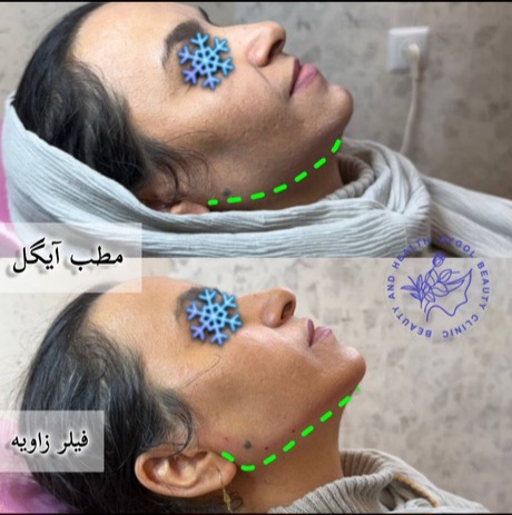 مطب زیبایی آیگل