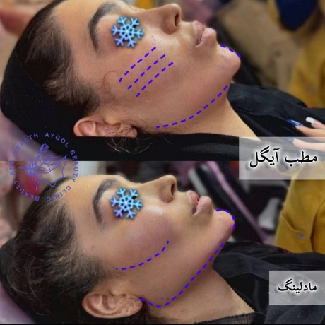 مطب زیبایی آیگل