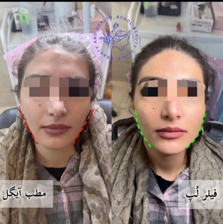 مطب زیبایی آیگل