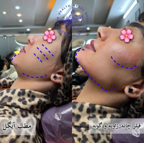 مطب زیبایی آیگل