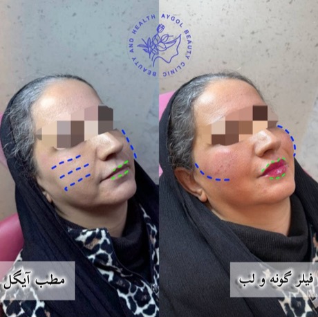 مطب زیبایی آیگل