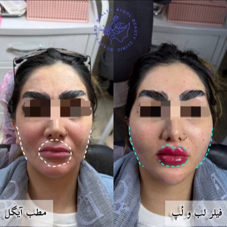 مطب زیبایی آیگل