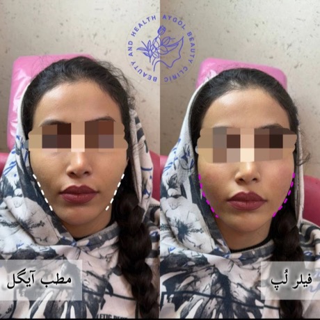 مطب زیبایی آیگل