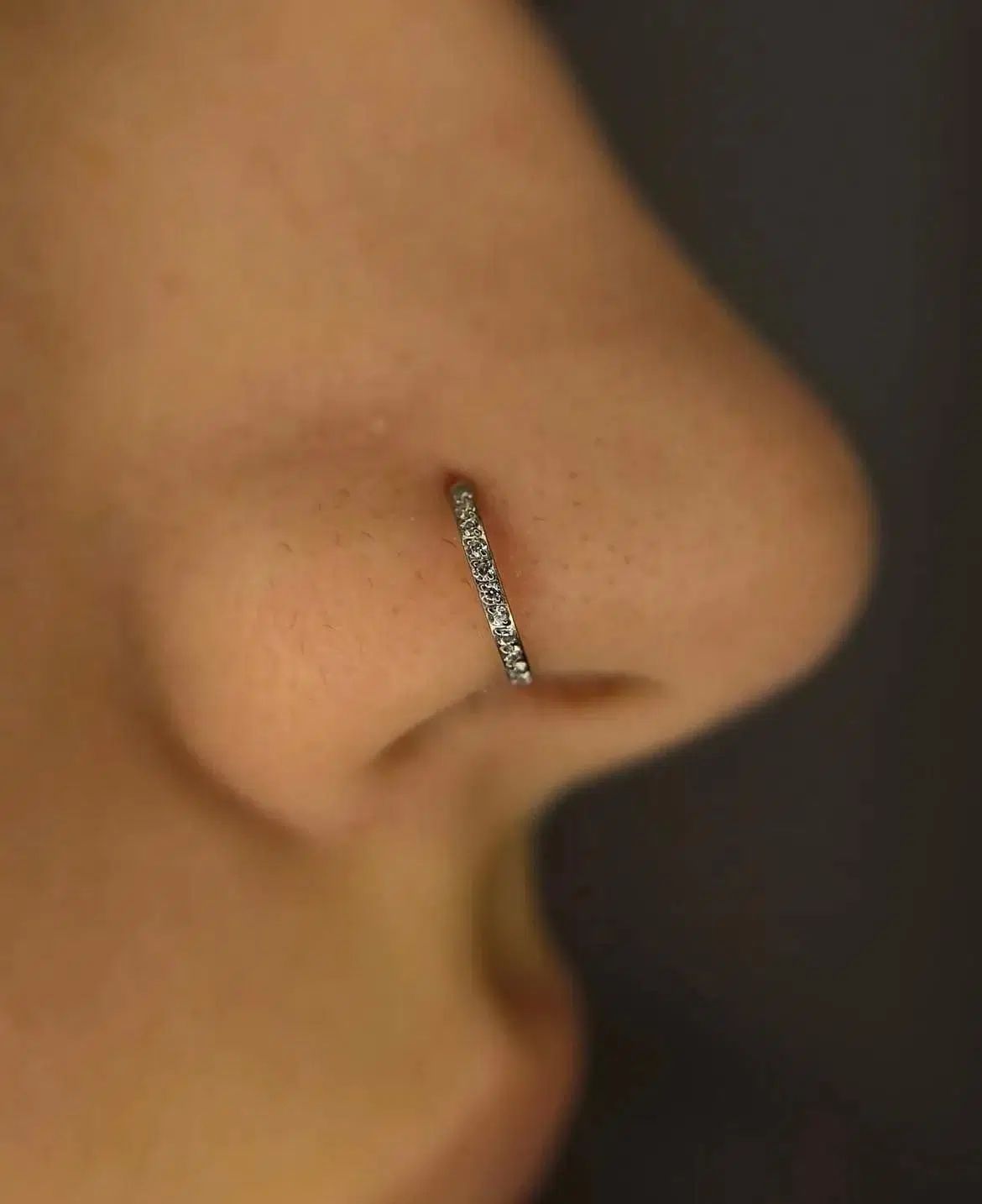چال گونه وپیرسینگ تخصصی