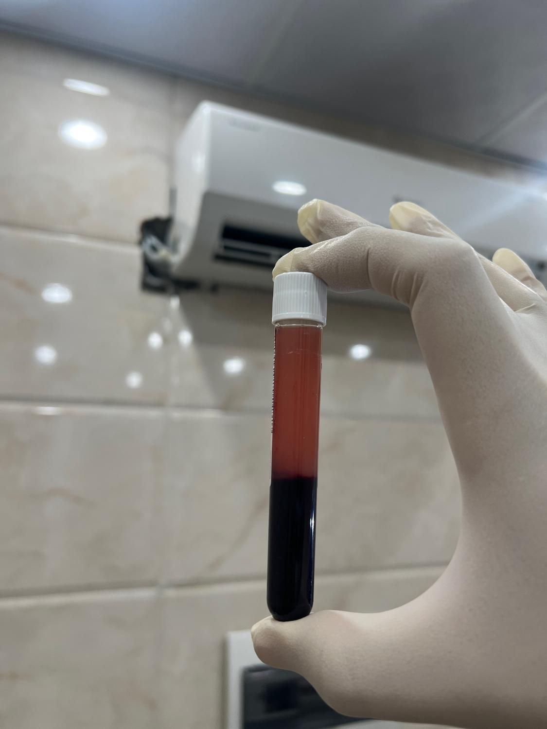 PrP