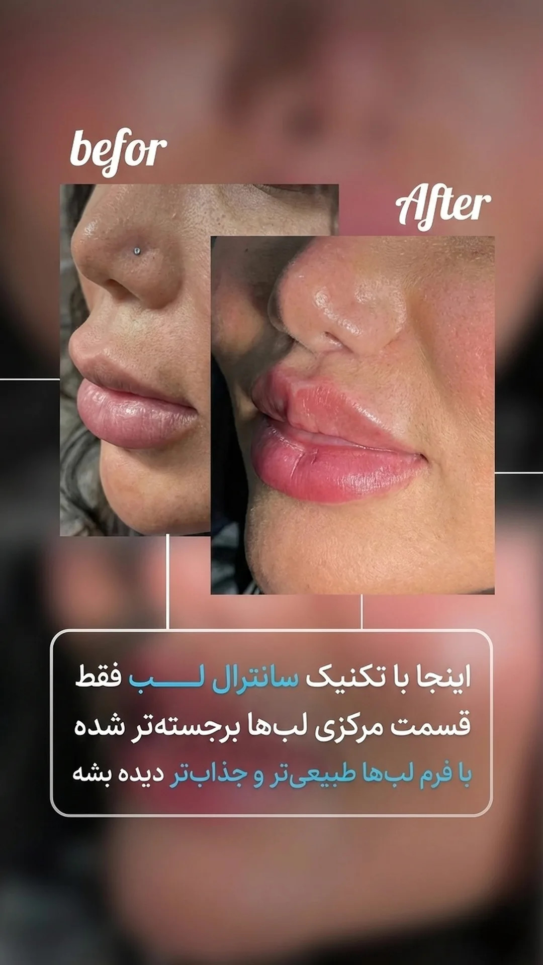 سانترال لب