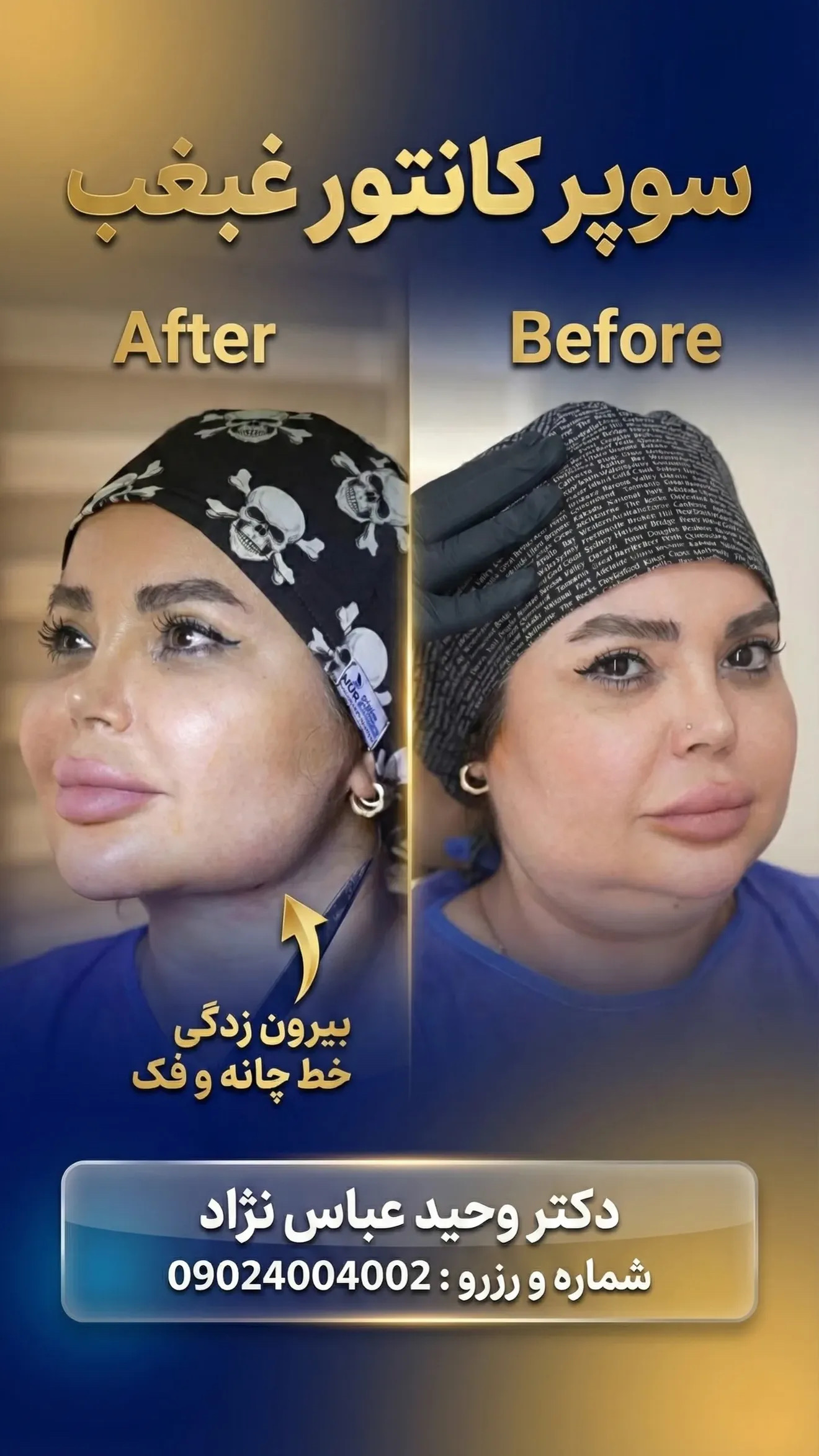 غبغب