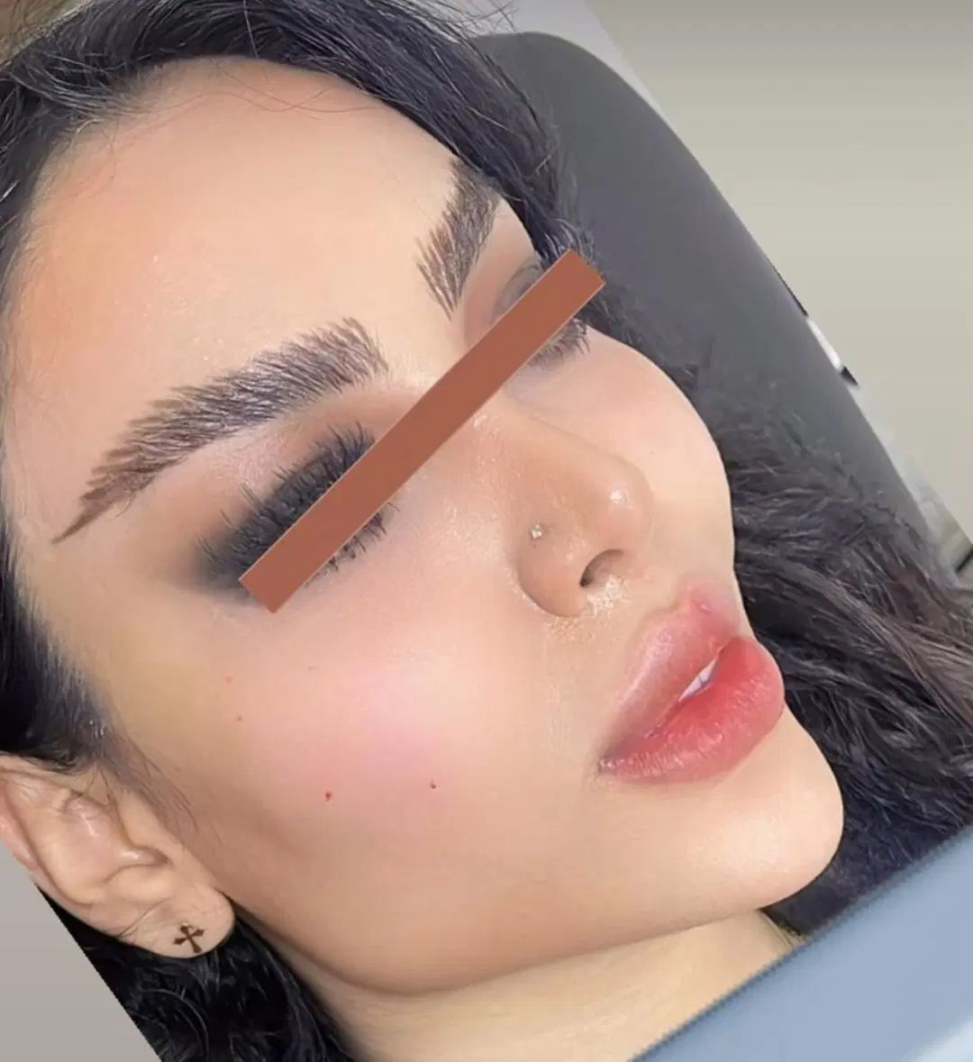 غبغب پیکرتراشی ژل بوتاکس بلفاروپلاستی تزریق چربی